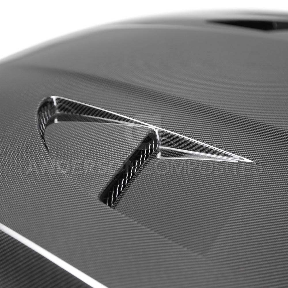 Anderson Composites Carbon Fiber Type SA Hood for MK3 Ford Focus